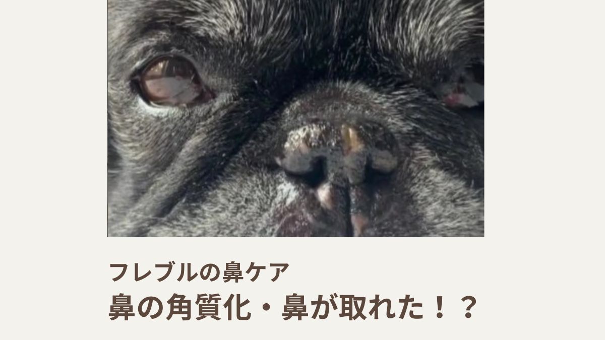 フレブルの鼻ケア｜鼻の角質化・鼻が取れた！？