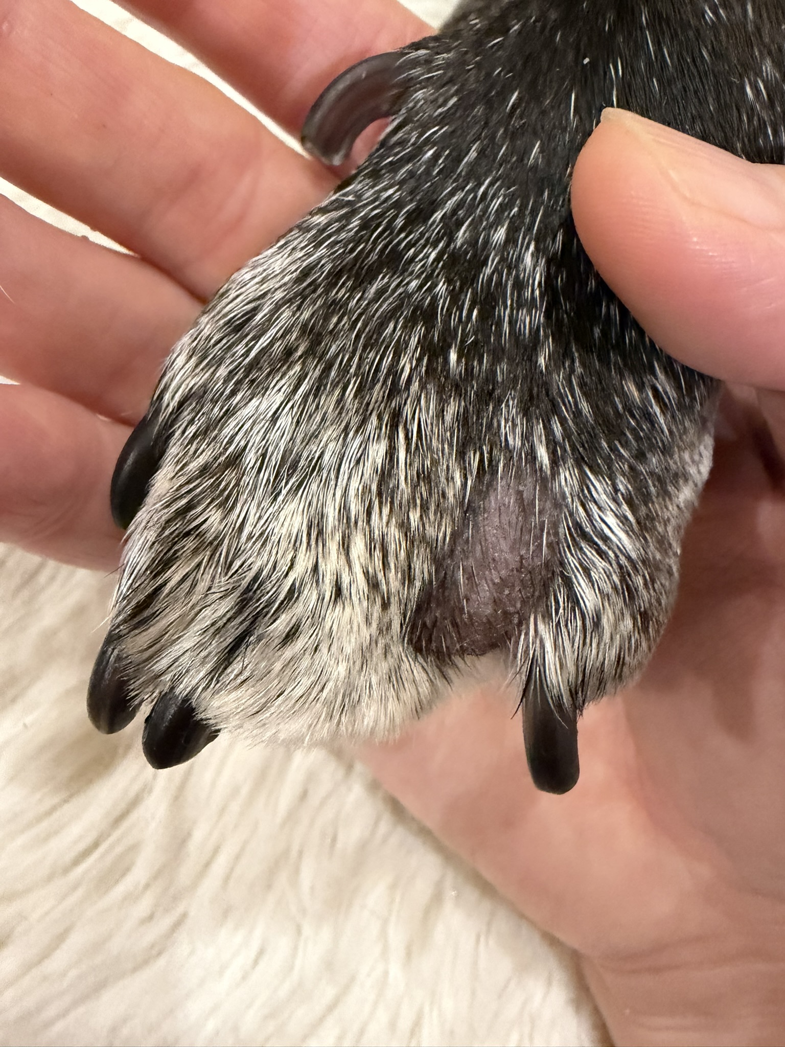 指間炎