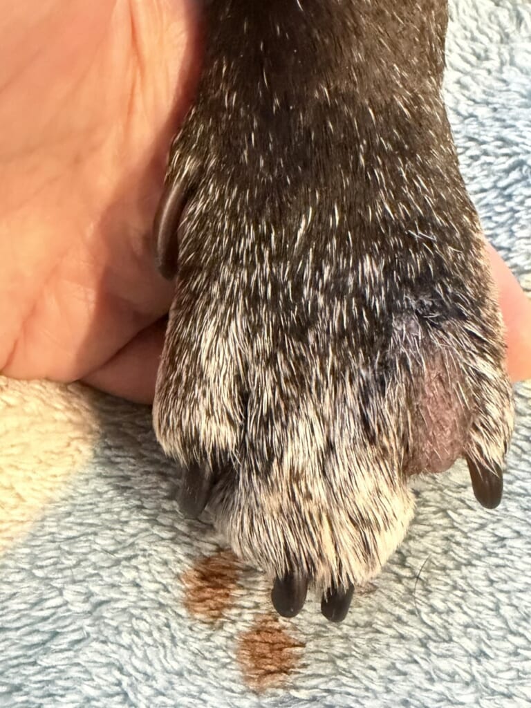 指間炎