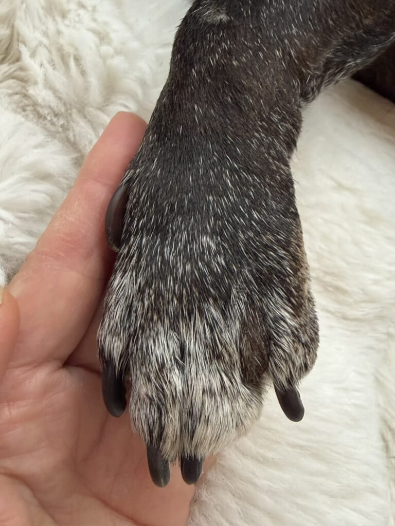 指間炎